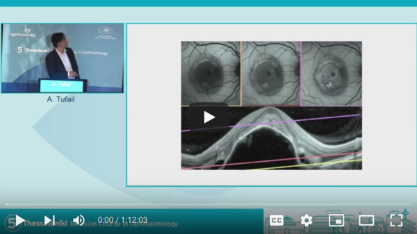 Day 2 - Medical Retina (Intermediate) 1 | 5th Thessaloniki Revision Course in Ophthalmology