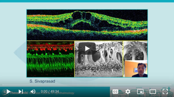 Day 2 - Medical Retina (Intermediate) 2 | 5th Thessaloniki Revision Course in Ophthalmology