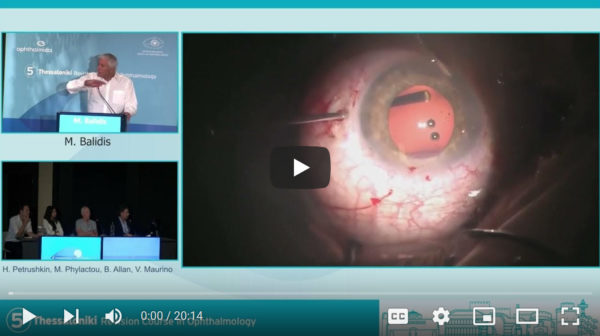 Day 3 - Video Challenging Cases (Cataract) | 5th Thessaloniki Revision Course in Ophthalmology