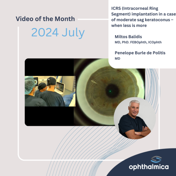 Video of the month | July 2024 | ICRS (Intracorneal Ring Segment) implantation in a case of moderate sag keratoconus – when less is more