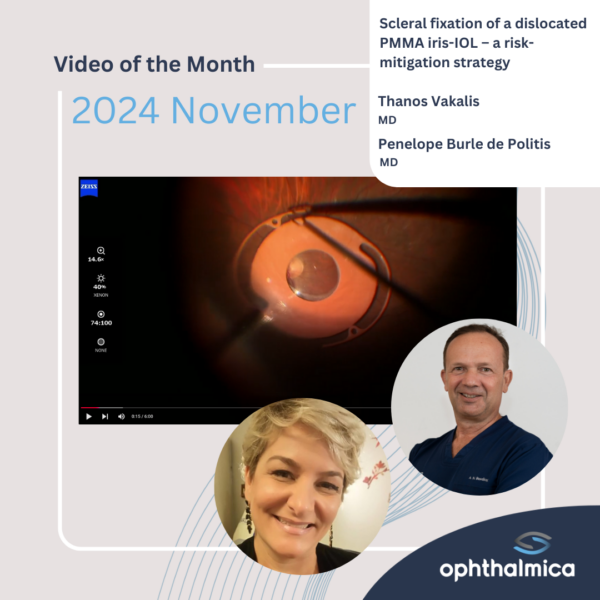 Video of the month | November 2024 | Scleral fixation of a dislocated PMMA iris-IOL – a risk-mitigation strategy