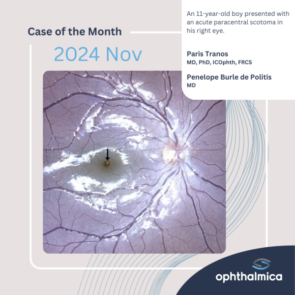 Case of the month (Nov 2024)